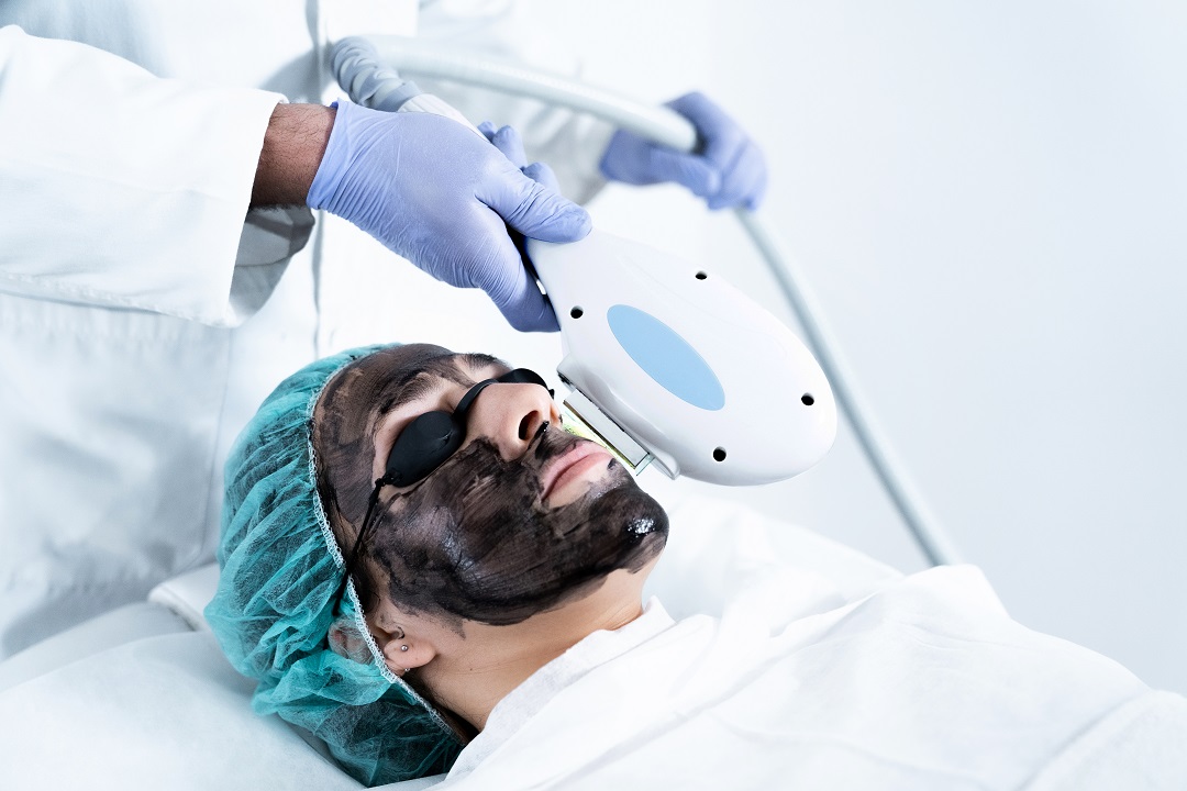 FHOS carbón activo FHOS carbón activo