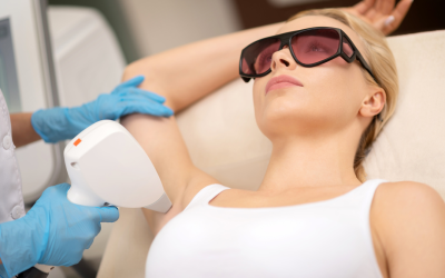 Descubre la Depilación Láser: Tu Guía Completa