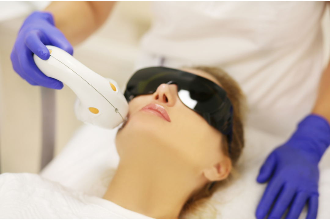 radiofreceuncia o fotorejuvenecimiento radiofreceuncia o fotorejuvenecimiento