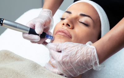¿Qué es el Microneedling?