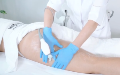 Consejos para combatir los problemas de hinchazón o circulación