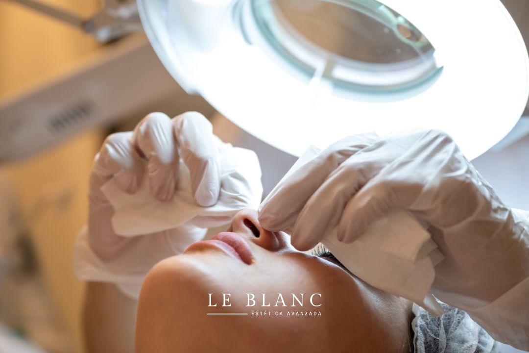 tratamiento higiene facial