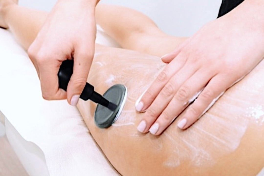 Tratamiento de INDIBA para piernas cansadas