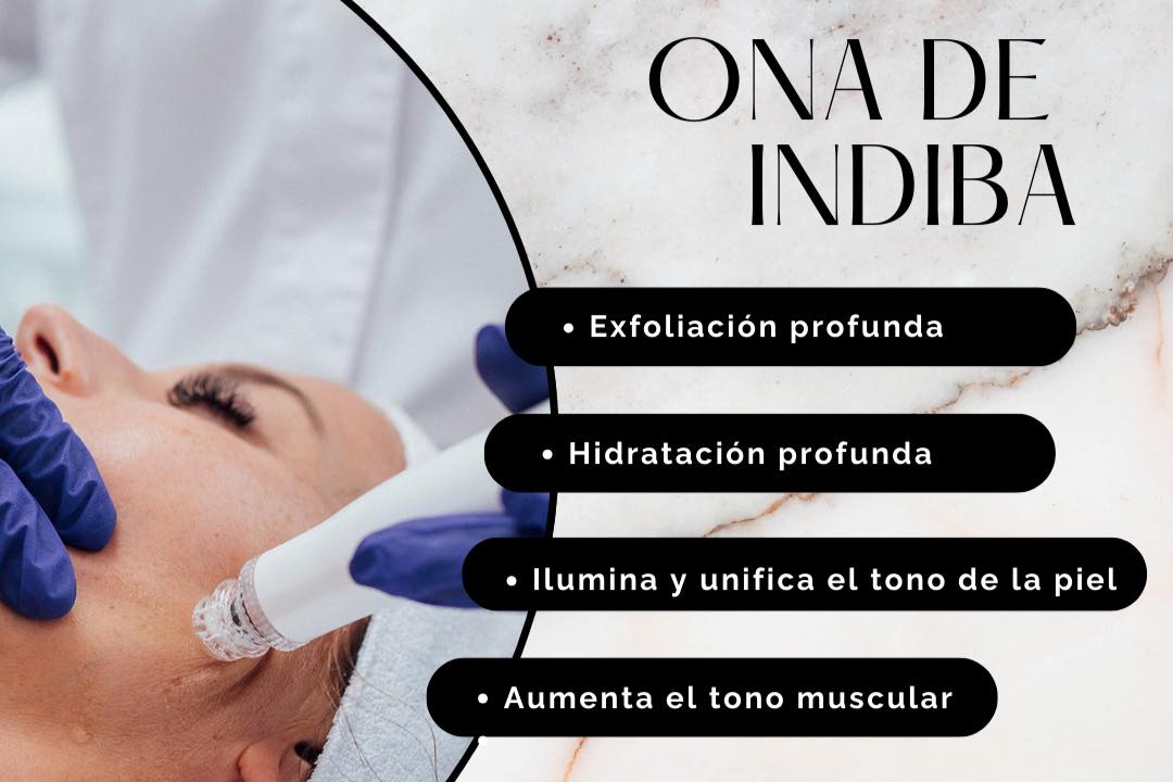 Limpieza profunda tras la Navidad limpieza profunda tras la navidad