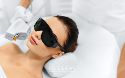 Revitaliza tu piel con IPL