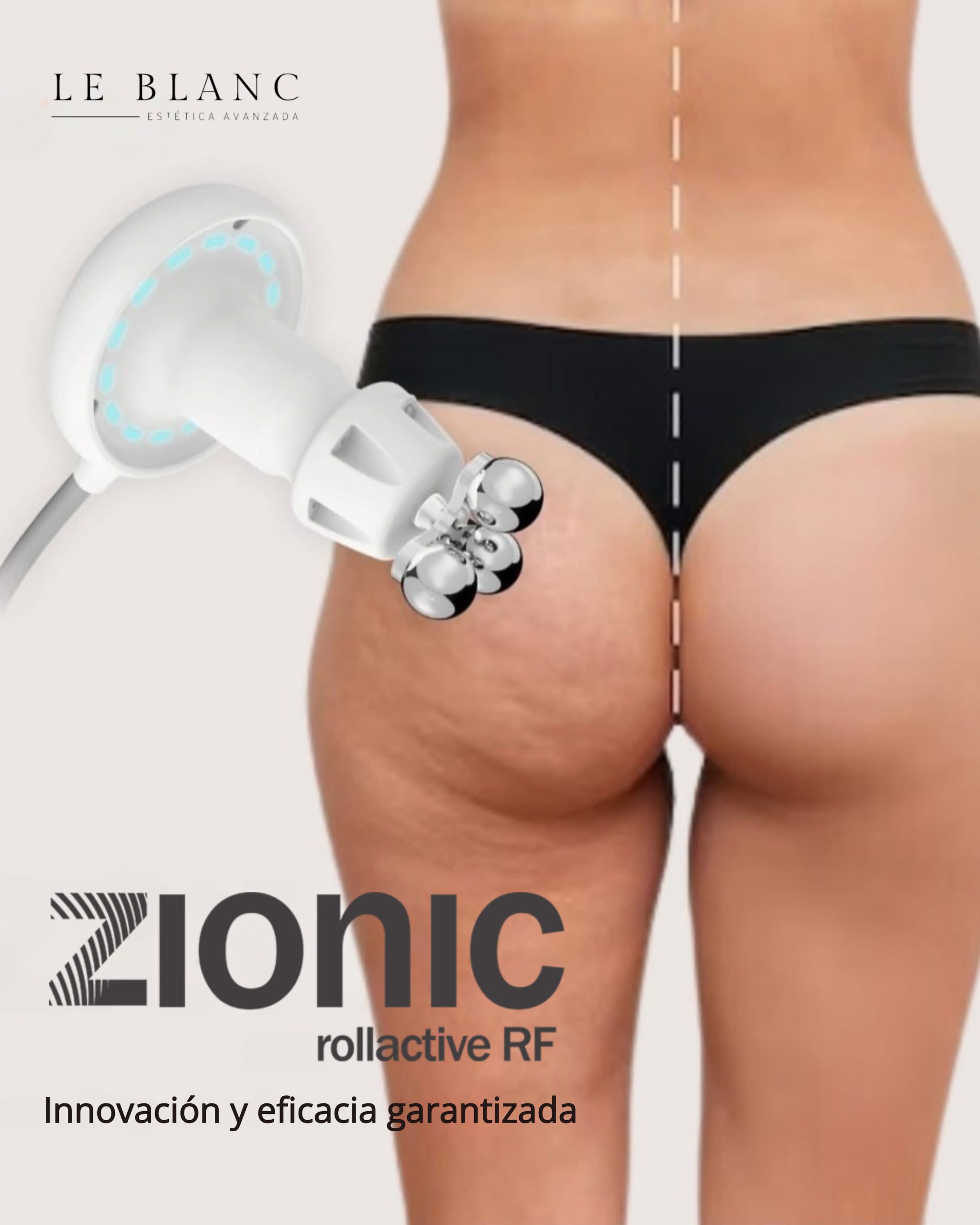 ZIONIC remodela tu figura