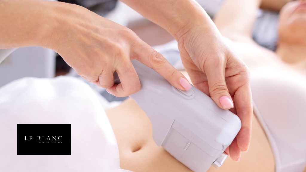 Diferencias entre Zionic e HIFU Diferencias entre Zionic e HIFU