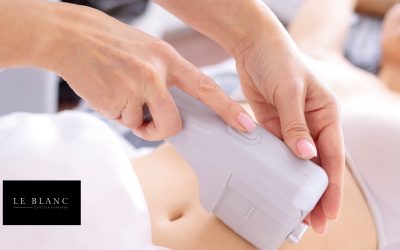 HIFU vs ZIONIC: diferencias, beneficios y cuál elegir | Le Blanc Alicante