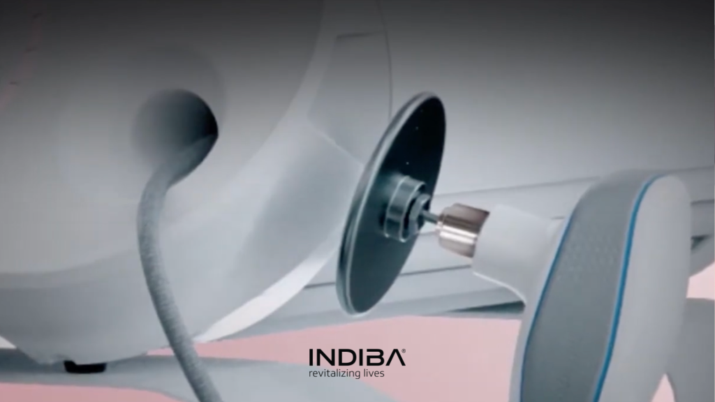 Radiofrecuencia normal vs INDIBA