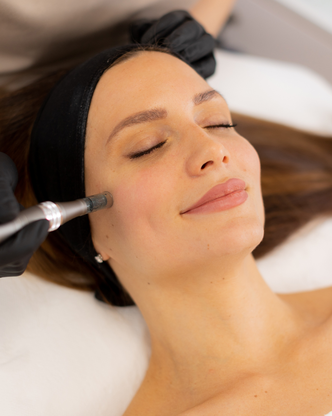 plasma pen en Alicante