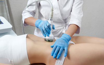 Radiofrecuencia estética: riesgos ocultos y la revolución segura de Indiba